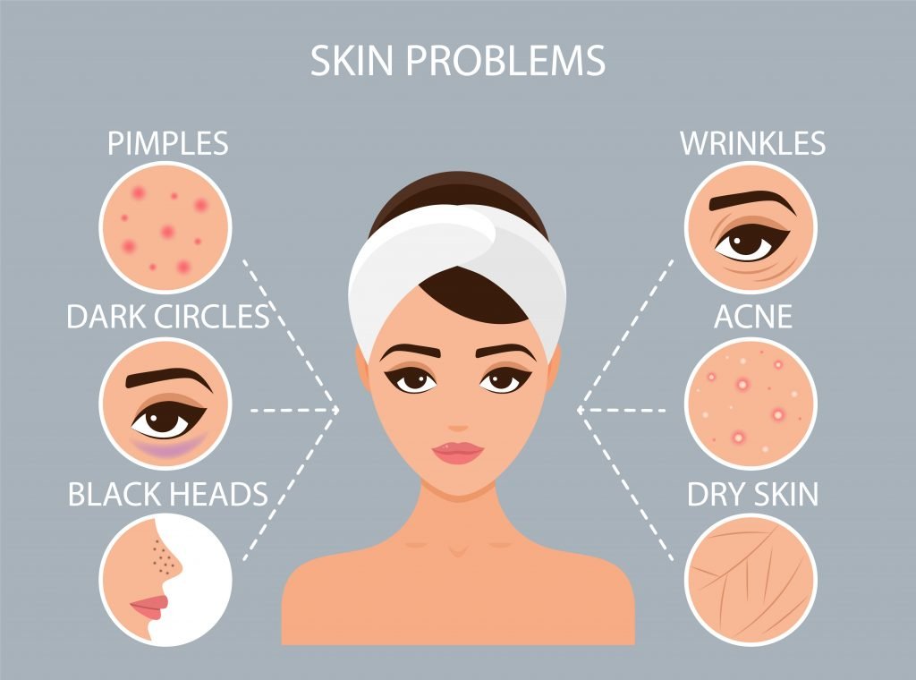 Girl has acne on her face. Before and after. Concept of skincare, pure and healthy skin. Vector illustration.
