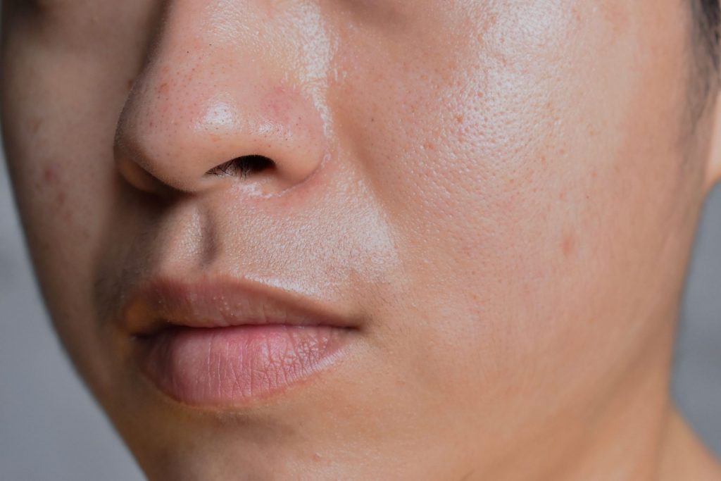What is the best skin care for oily skin?